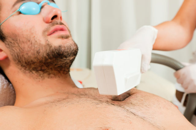 Laser Hair Removal Male (Cold Laser)